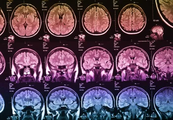 Когда любимая песня — как укол морфия: как мозг узнаёт счастье от музыки