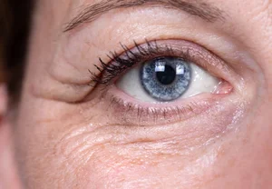 Зачем смотреть в паспорт, если под глазами всё написано?