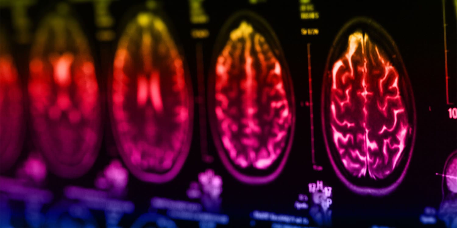 Бах, микросхемы и предсказания: как мозг превращает музыку в расчёты и ошибки