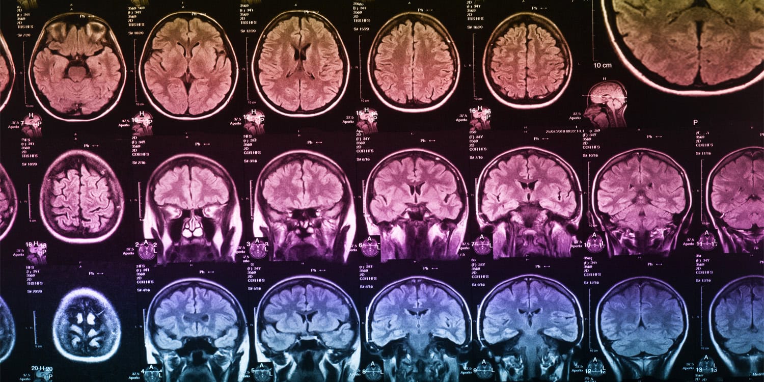 Когда любимая песня — как укол морфия: как мозг узнаёт счастье от музыки