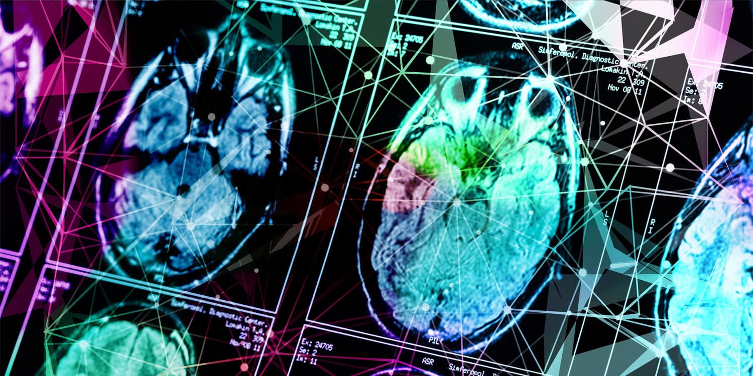 Генетика, МРТ и вся правда про импульсивность: Как ученые пытаются разоблачить СДВГ у детей