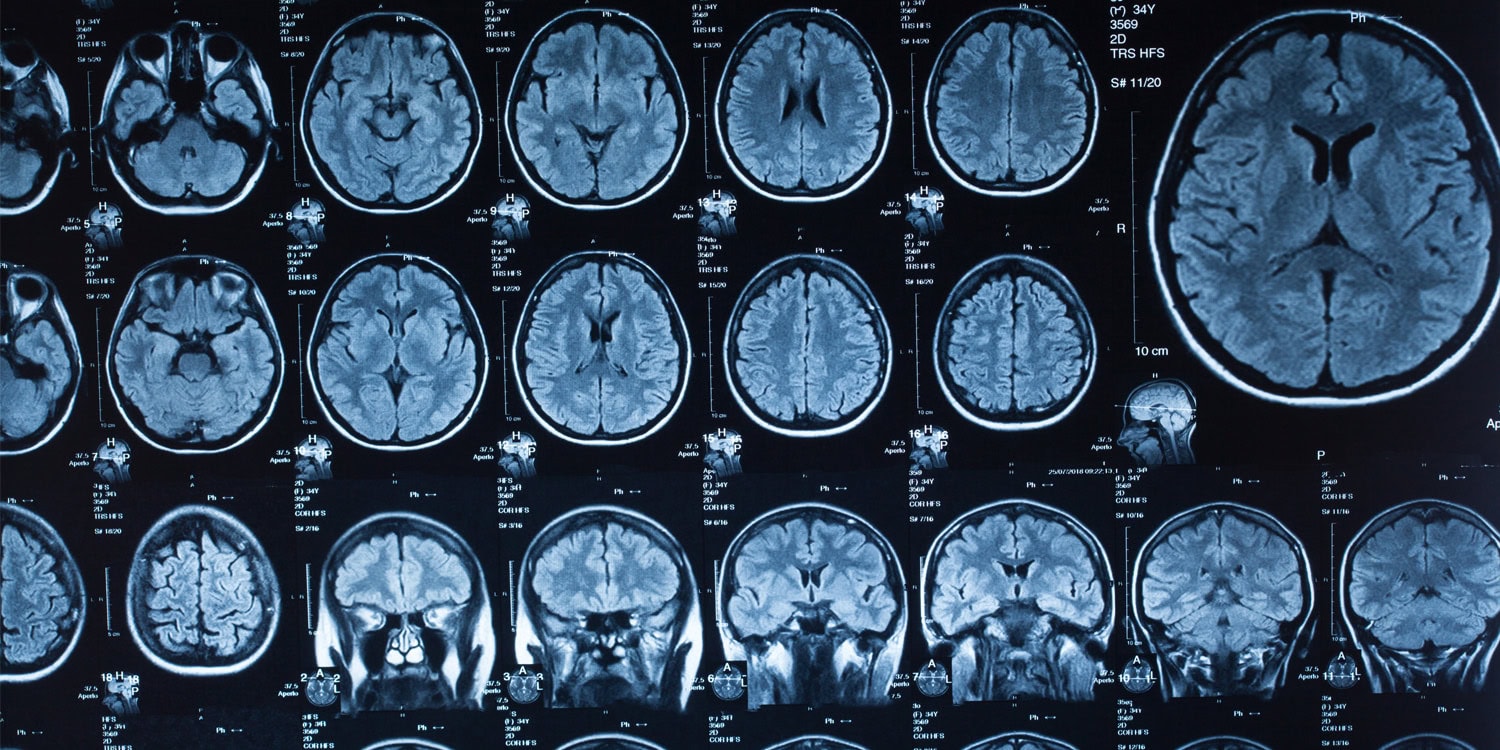 Пять фаз человеческого мозга: от катания в коляске до боя с пенсионкой